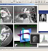 画像処理診断ソフト：i-View（アイビュー）